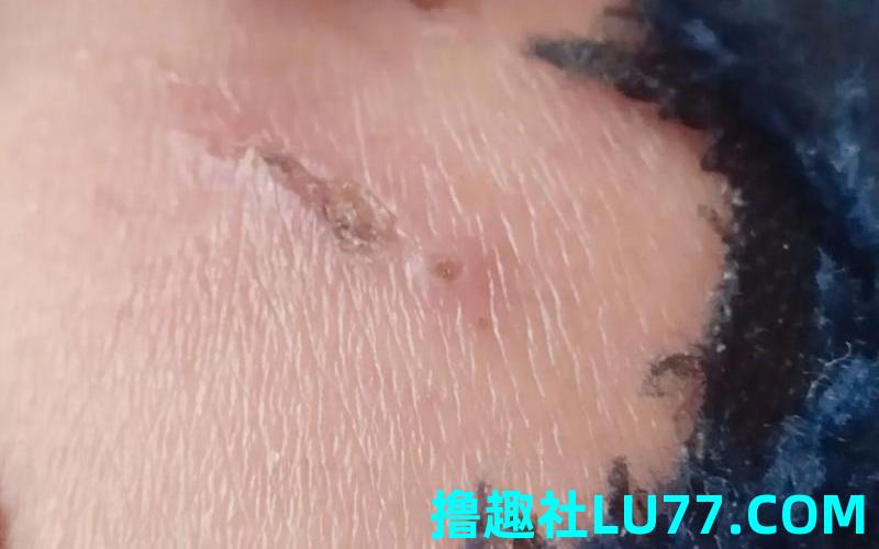 梦见钻洞受伤 梦见钻洞受伤