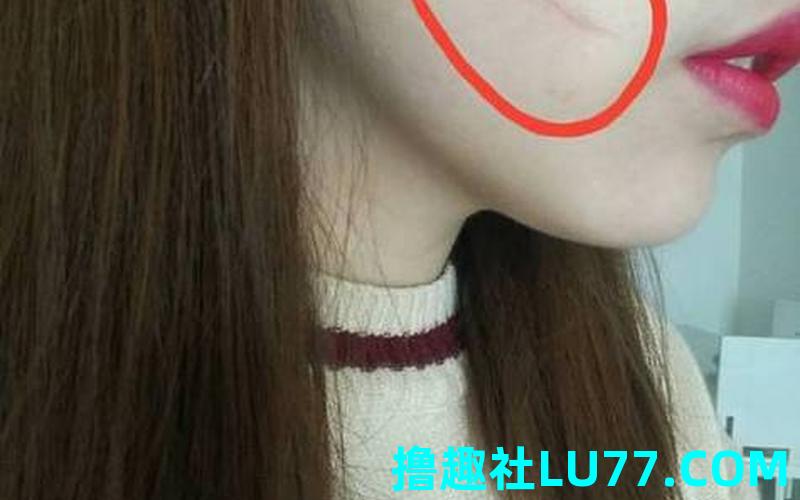 梦见自己脸受伤