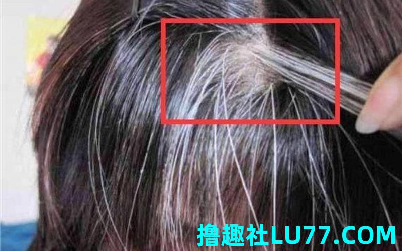 梦见自己长很多白头发 梦见自己长很多白头发