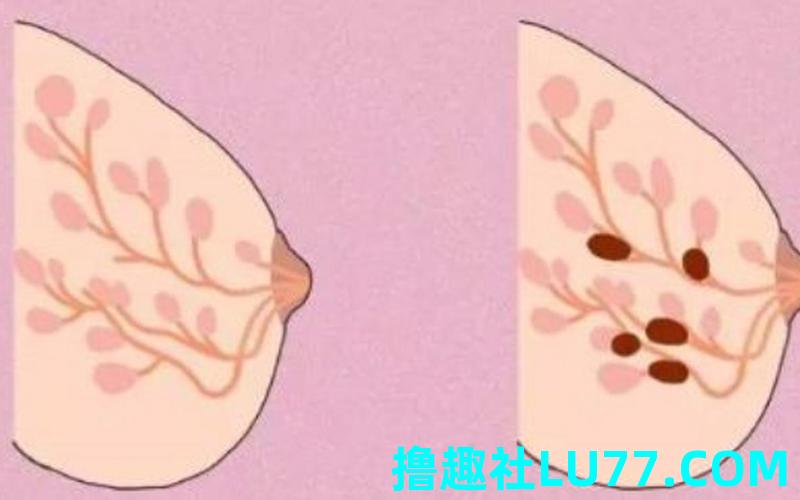 梦见乳