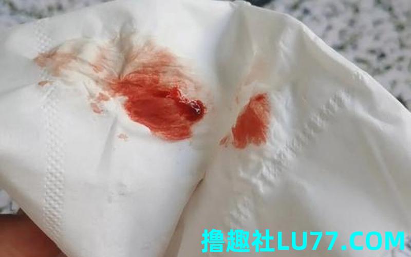 梦见亲人流了好多血 梦见亲人流了好多血