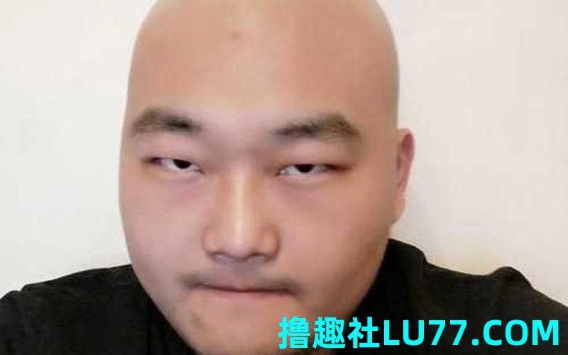 梦见剔秃头 梦见剔秃头