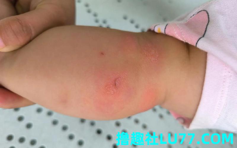 梦见虫子在包里 梦见虫子在包里