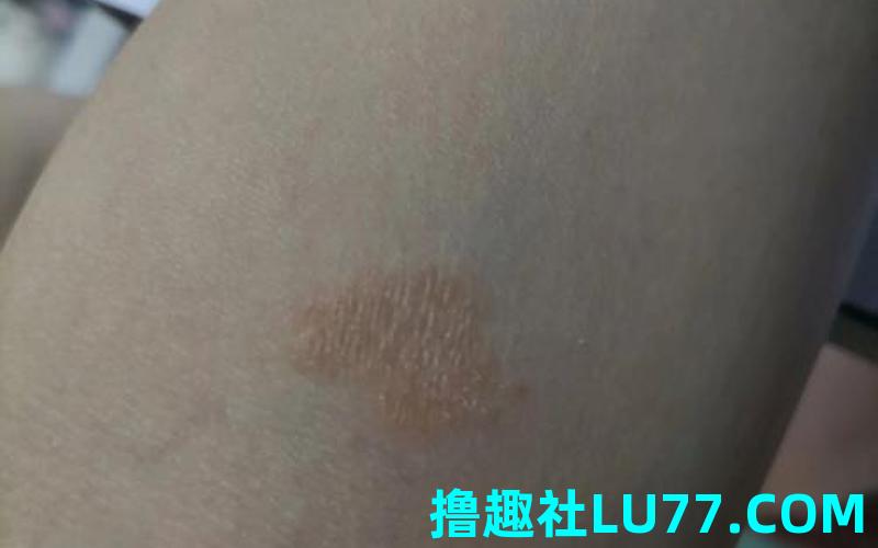 梦见皱 梦见皱
