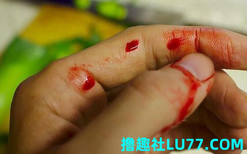 被亲人梦见满脸是血