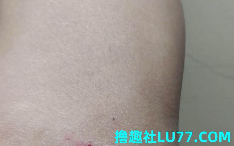 梦见让狗把脚咬出血了
