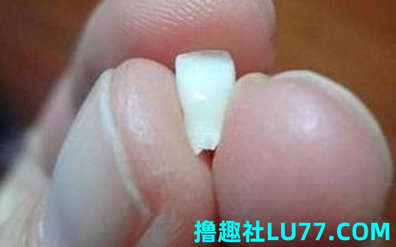 孕妇梦见自己牙齿松了