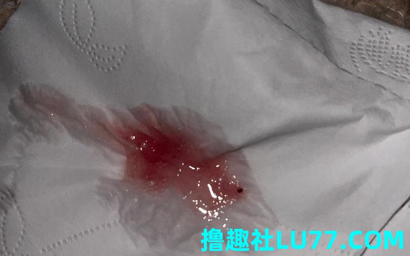 梦见早晨吐血