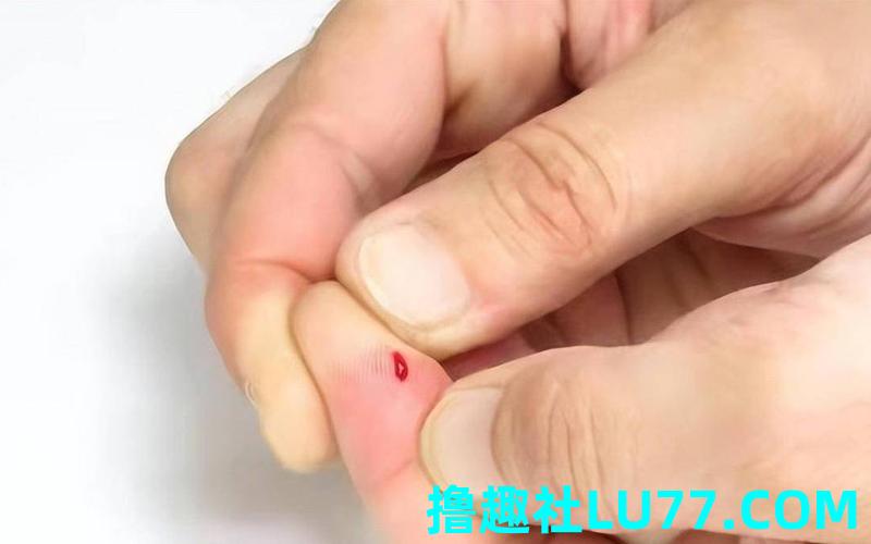 梦见别人刺伤我 梦见别人刺伤我