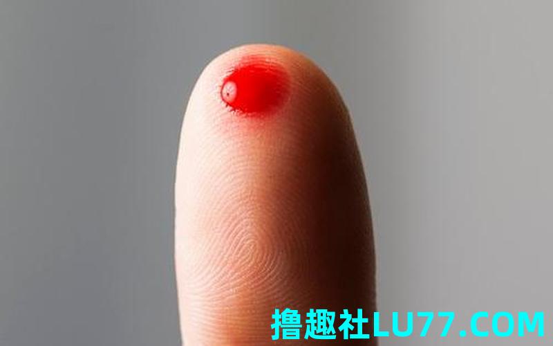 梦见手指受伤流好多血是什么意思