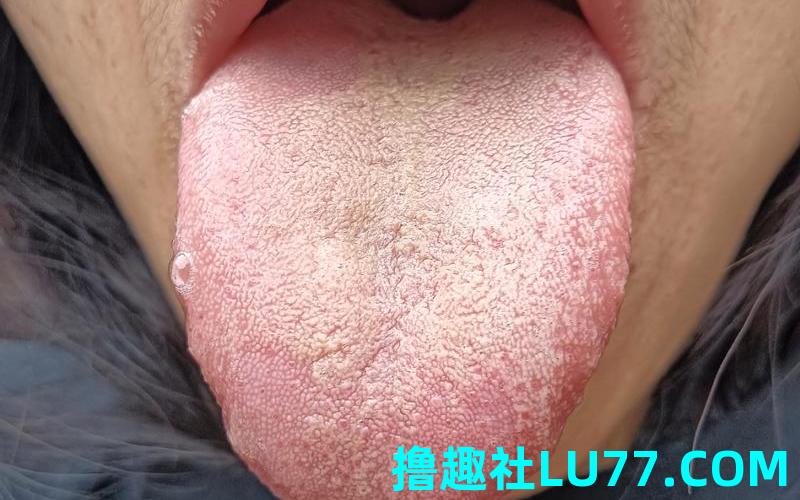 梦见自己很多舌苔 梦见自己很多舌苔