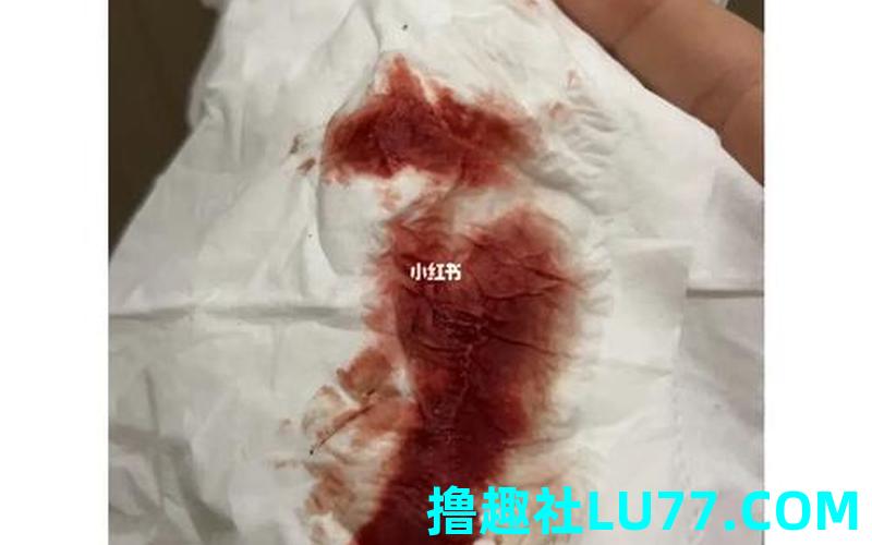 怀孕初期梦见下体流血