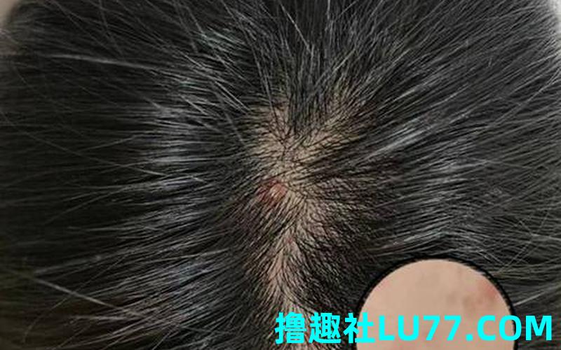 梦见自己露头皮