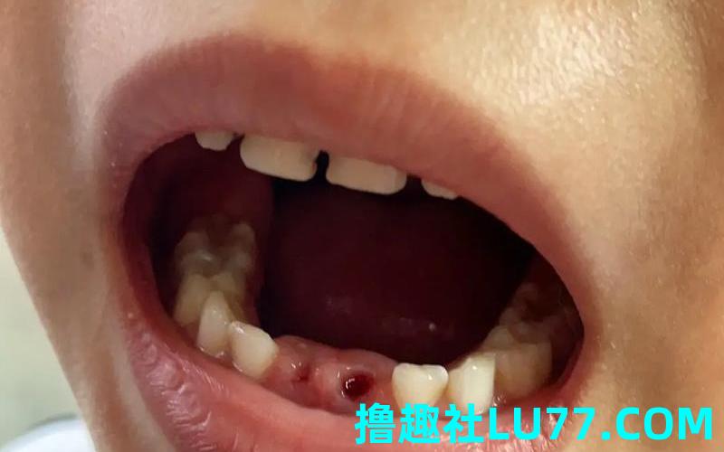 梦见牙根