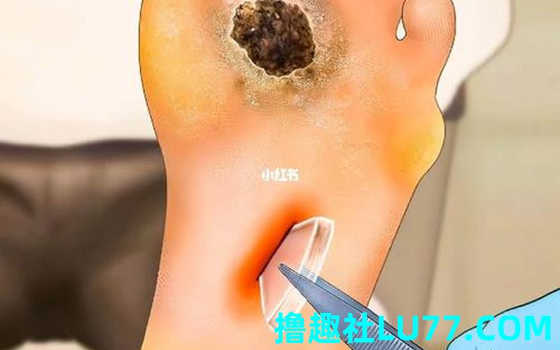 梦见玻璃扎脚 梦见玻璃扎脚