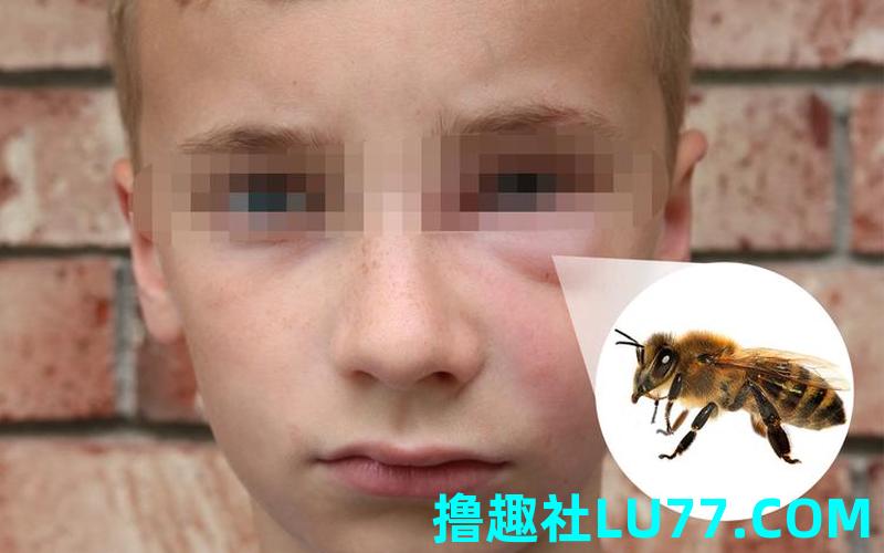 梦见蜂子蛰人