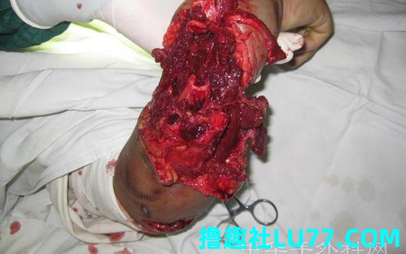 梦见相互砍 梦见相互砍