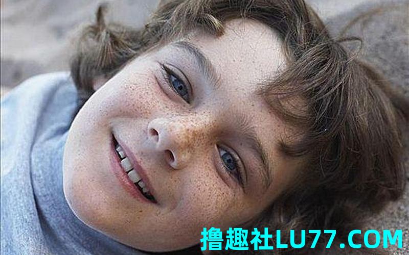 梦见雀斑脸