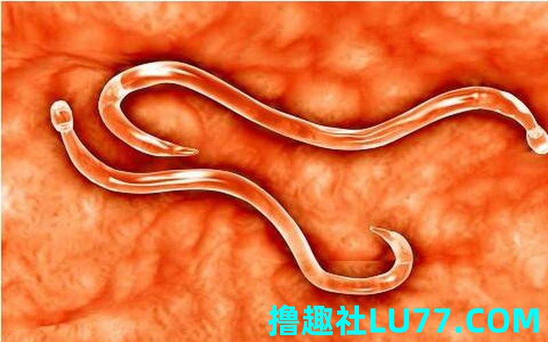 梦见的虫子