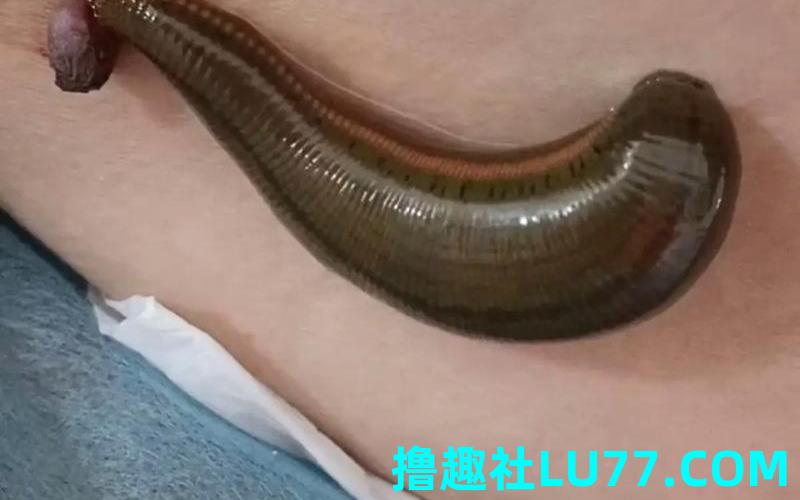 梦见蚂蝗咬疼