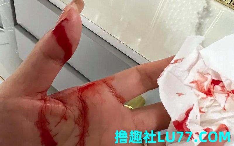 梦见亲人流血 梦见亲人流血