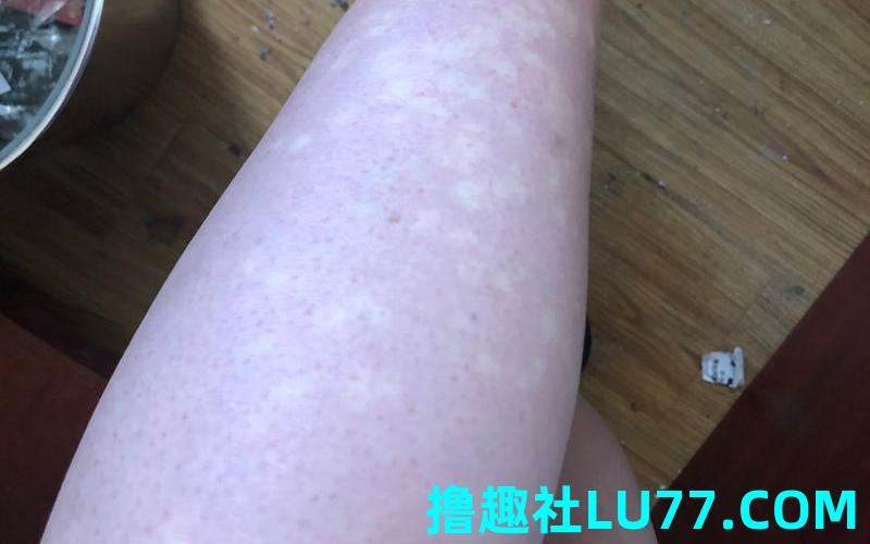 梦见自己腿上长草 梦见自己腿上长草