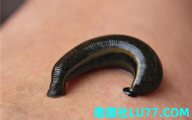 梦见吸血虫子 梦见吸血虫子