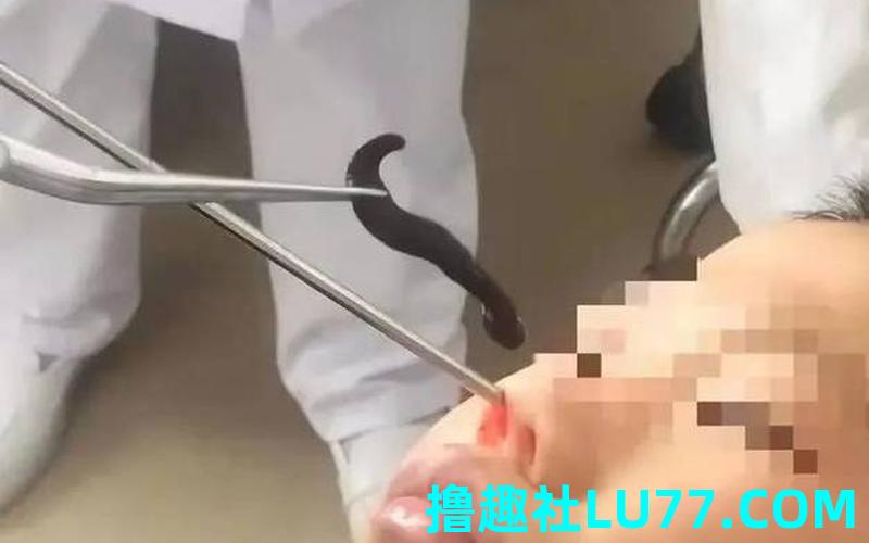 梦见鼻子里抽出异物