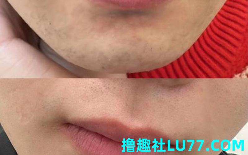 梦见没刮胡子 梦见没刮胡子