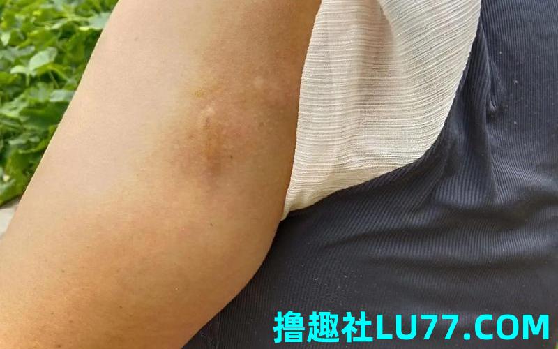 梦见被够狗咬没出血 梦见被够狗咬没出血