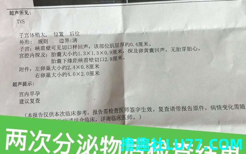 梦见医生说流产