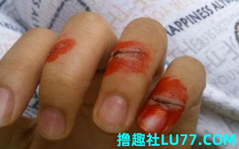 梦见解手见血