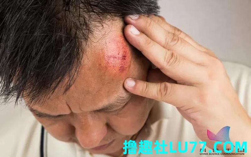 梦见打人头部