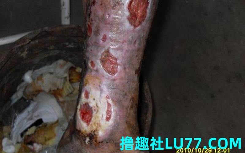 做梦梦见腿烂了