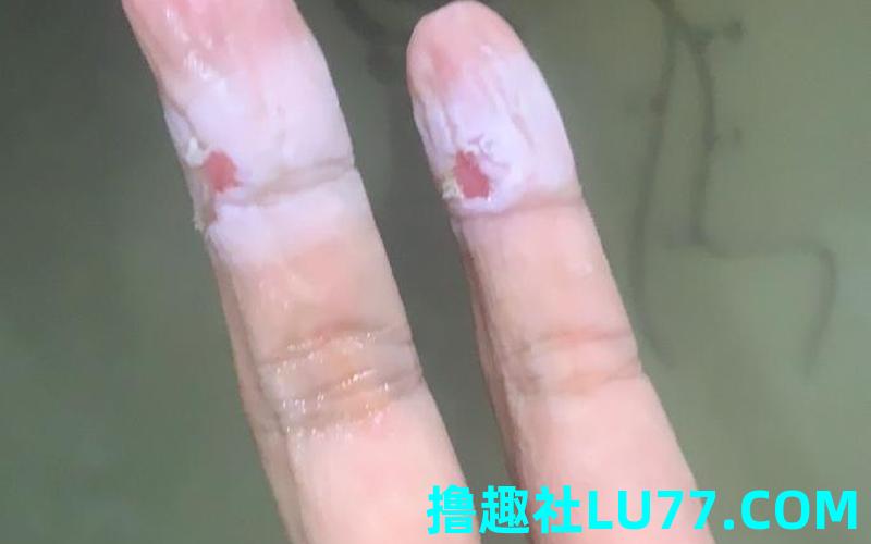 梦见手发白了