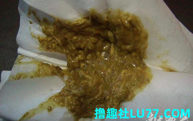 梦见鸭子拉屎
