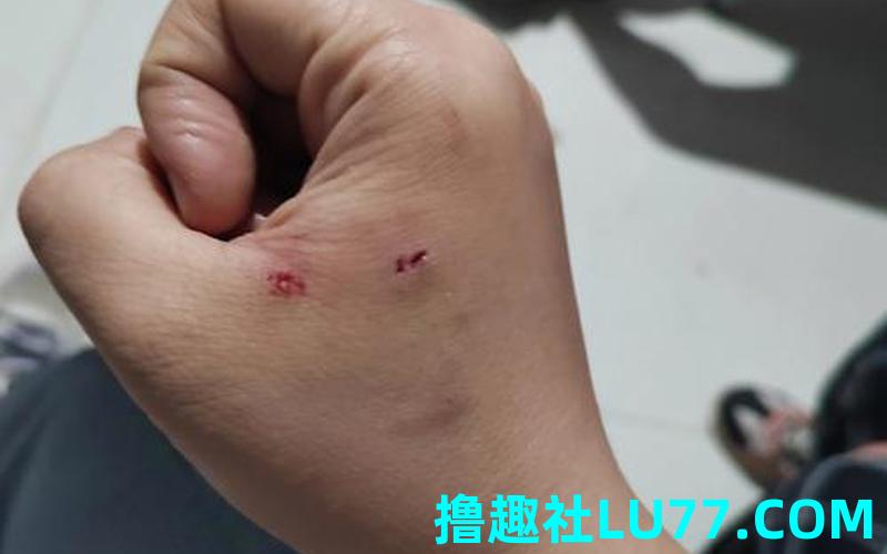 梦见猫咬我的手流血 梦见猫咬我的手流血