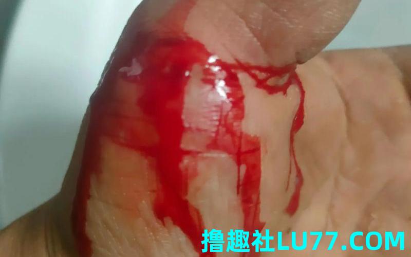 梦见自己伤口裂开流血