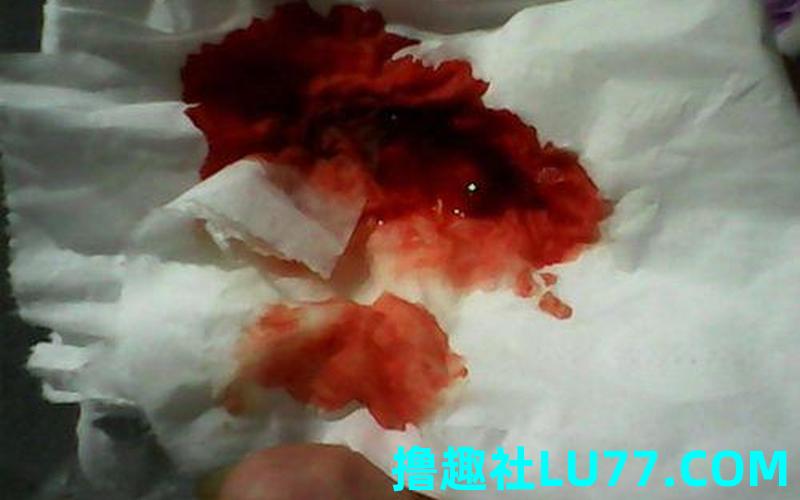 梦见受伤吐血