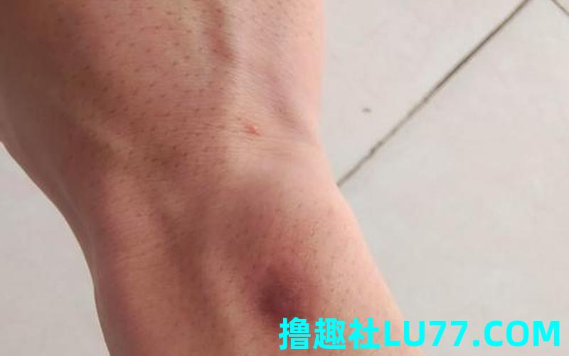 梦见别人被烟烫