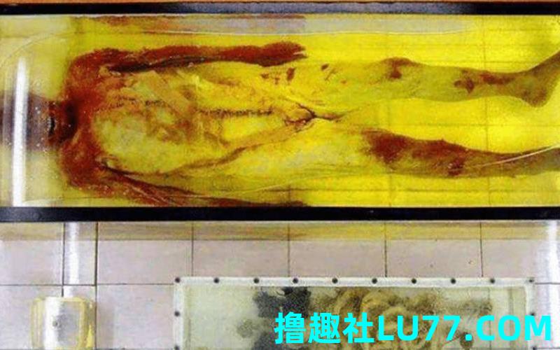 梦见老公尸骨