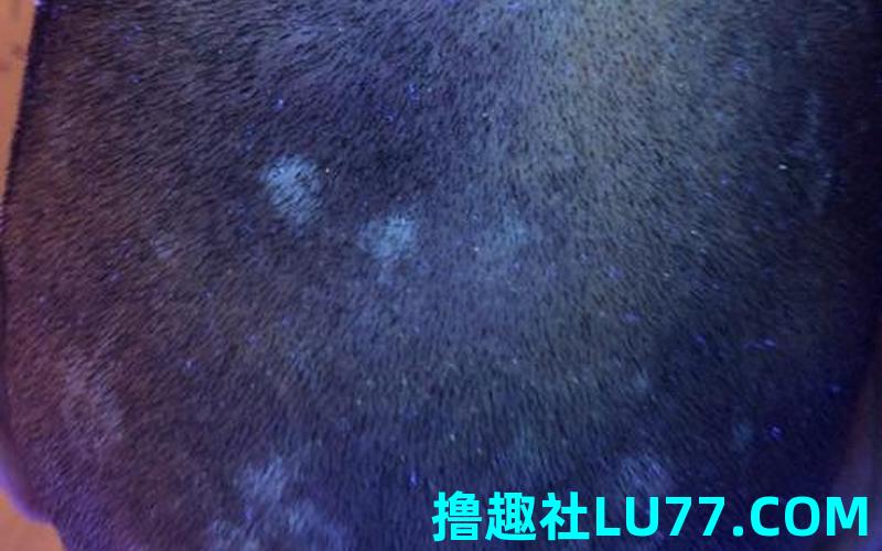 梦见自己头上有白头发