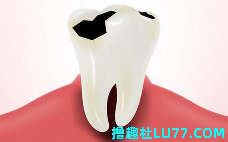 梦见妻子蛀牙 梦见妻子蛀牙