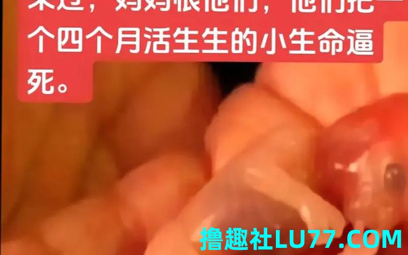 梦见老婆生了怪胎 梦见老婆生了怪胎