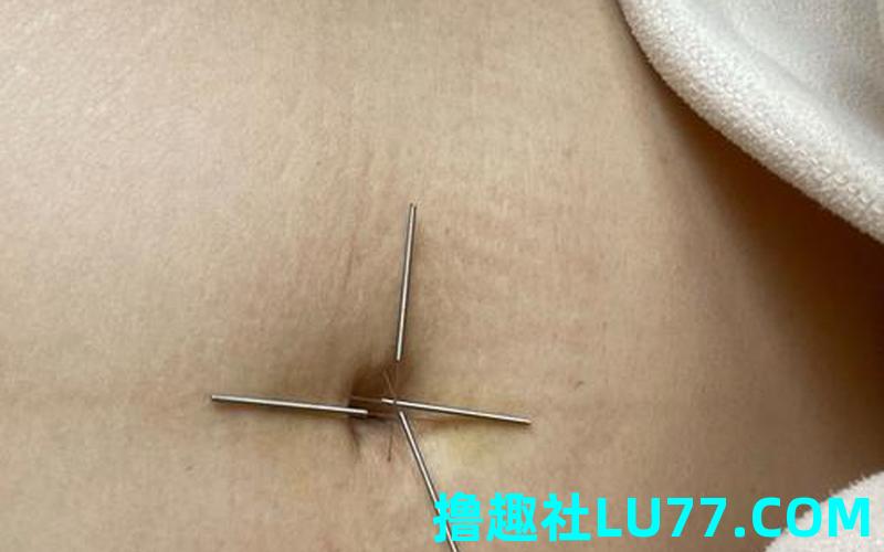 梦见针 梦见针