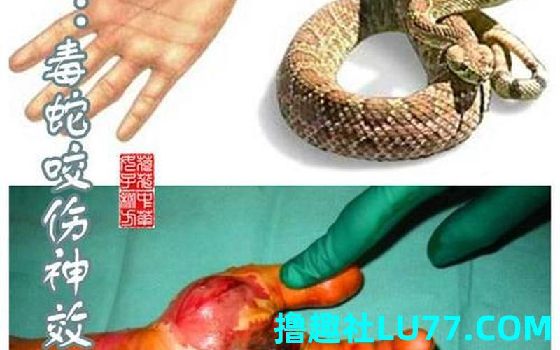 梦见被蛇咬手了 梦见被蛇咬手了